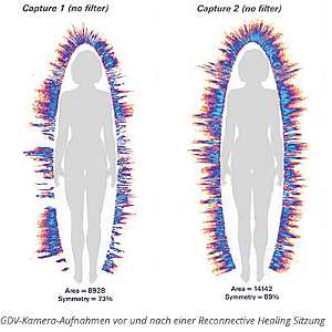 Energiefelder vor und nach Behandlung