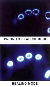 Energiefelder vor und nach Behandlung